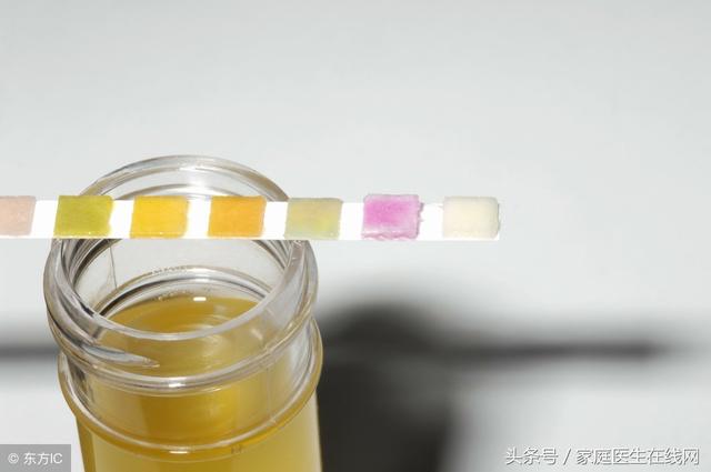 怎么避免孩子尿路感染