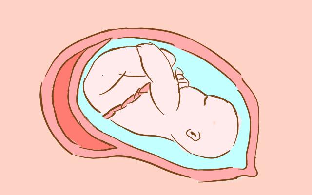 怀孕期间，这些行为易导致胎儿脐带绕颈