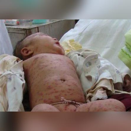 桂林疫情顺口溜大全相关长尾关键词有哪些