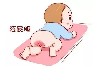 尿布疹类型多