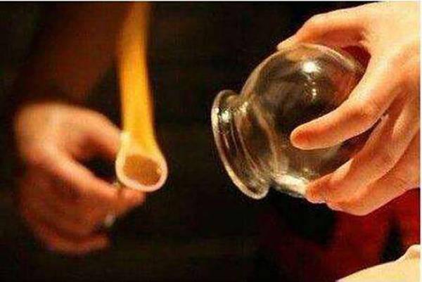 拔火罐后的印子颜色越深越有效吗