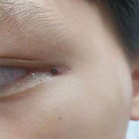 [苏州有名气的皮肤科]长尾关键词有什么