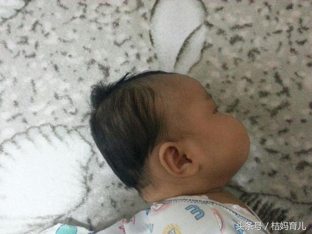 孕妇吃橘子宝宝会黄疸吗