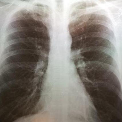 气管炎患者适合做什么运动的长尾关键词有什么