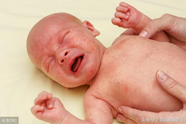 宝宝刚生出来就挤乳头好吗
