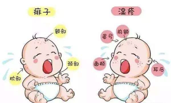 夏天宝宝痱子和湿疹区别