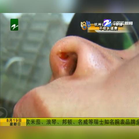 宁波尚美整形招聘的长尾关键词有什么