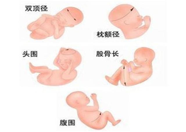 怎么准确鉴定胎儿性别