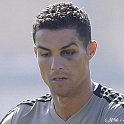 足球比赛肘击流血的长尾关键词有什么