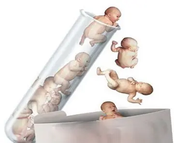 双子宫能不能做试管婴儿，双子宫女性做试管的5大条件详解