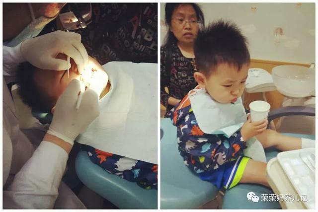 乳牙龋病需要治疗吗
