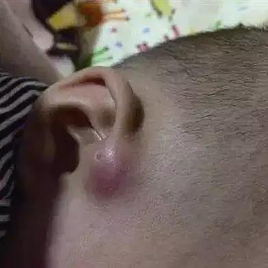 温州市看耳鼻喉哪里好些的长尾关键词有什么