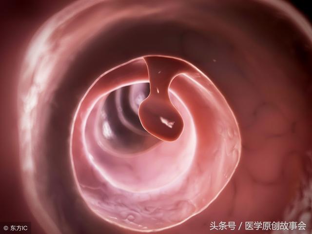 孩子这三种腹痛不是病