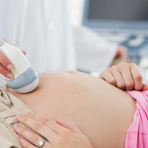 四维彩超网上预约流程？