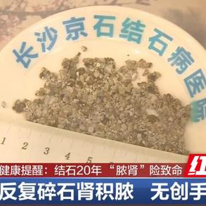 长沙京石结石病医院相关长尾关键词有哪些