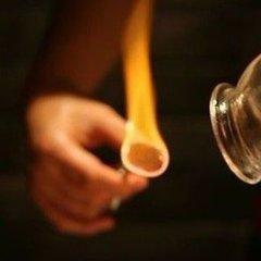 **湿疹患者能否拔罐？拔罐对于湿疹治疗的影响分析**-第3张图片-其人生活百科