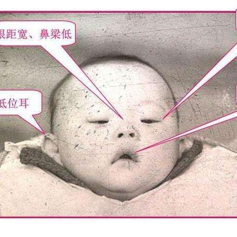 羊水穿刺结果出炉所需时间解析-第1张图片-其人生活百科