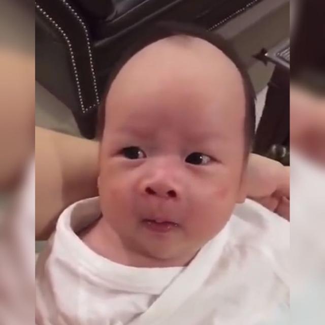孩子头发稀少是什么情况