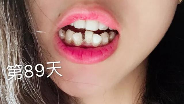 想让宝宝有一口好牙？宝宝牙齿护理注意这6点