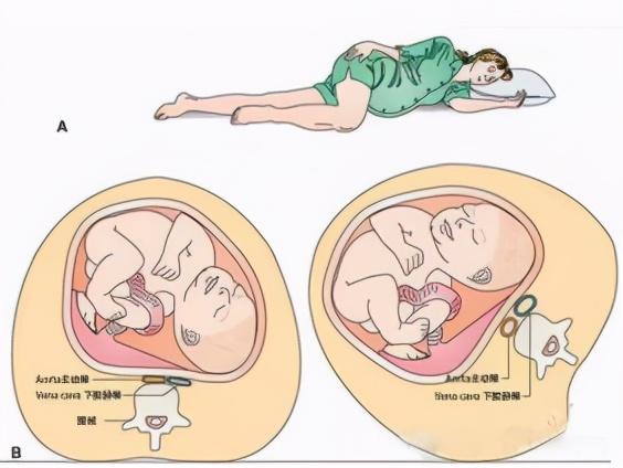 孕妇宫寒对胎儿的影响都有哪些呢