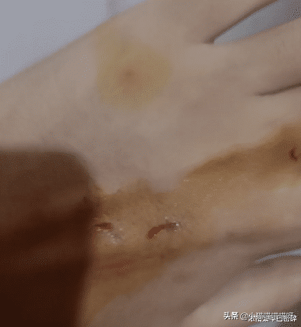 孕期老是手脚发麻是什么原因