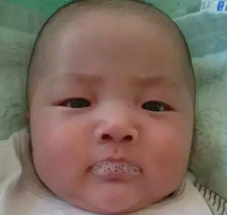 宝宝吐泡泡就是肺炎吗