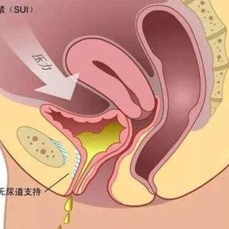 沈阳水下分娩的相关长尾关键词有哪些