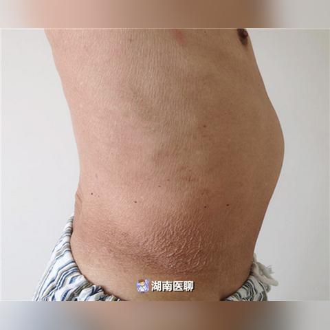 足球运动员怎么控制饮食的长尾关键词有什么