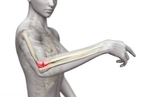 得网
 ,得网球肘的原因是什么