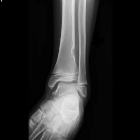 皮质足球脏了怎么洗