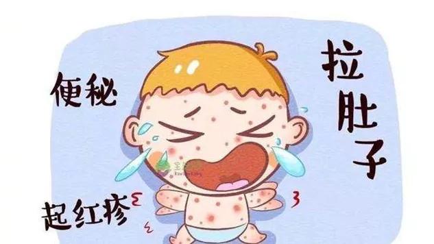 宝宝牛奶蛋白过敏要提前准备什么