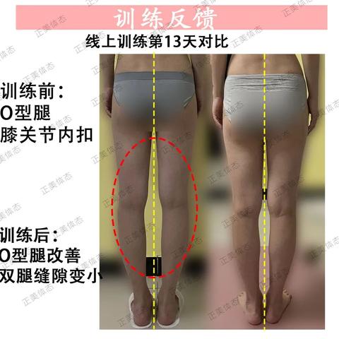 武汉市o型血什么意思