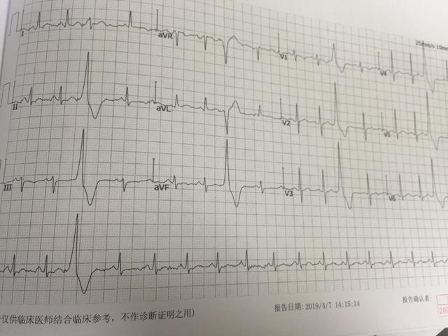 血常规可以检查出哪些疾病