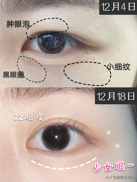 孩子不配合推拿怎么办
