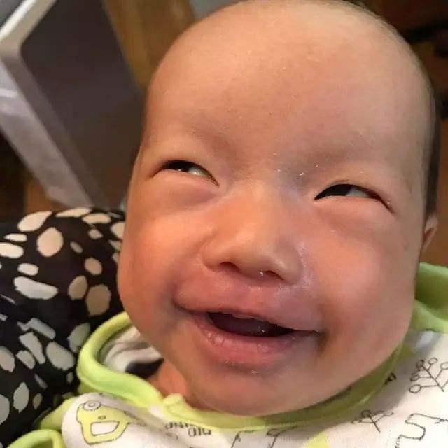 宝宝睡觉翻白眼是什么原因