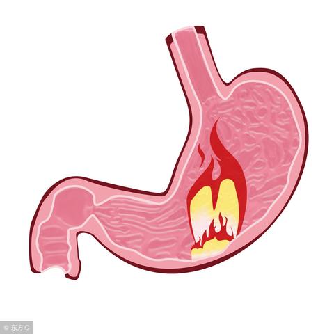 铝碳酸镁咀嚼片(铝碳酸镁咀嚼片,用途、优势与使用指南)