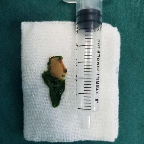 沈阳市医大四院是哪个区