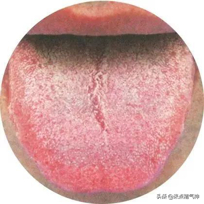 宝宝手心发热系上火