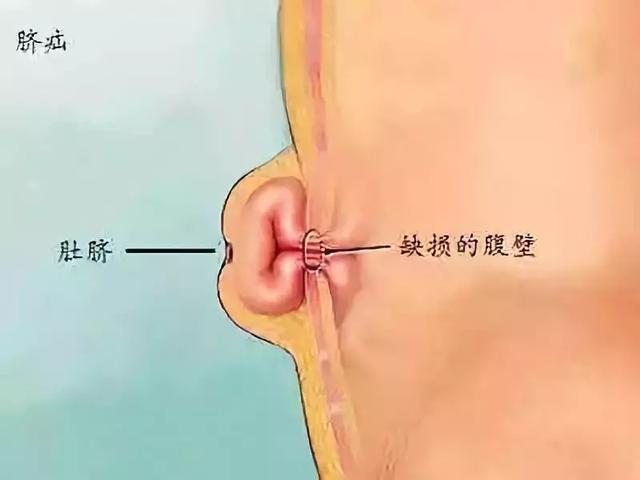 早产儿有5大特点