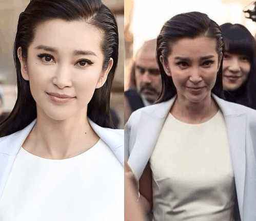 怀孕妊娠线长歪了是怎么回事