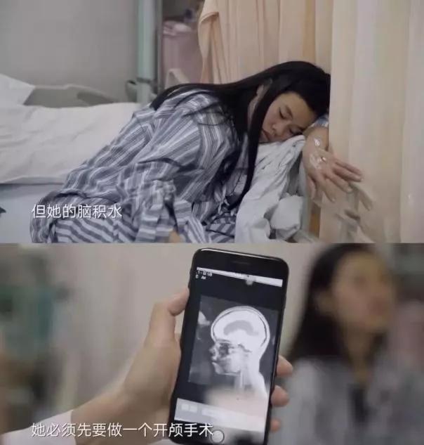 关剖宫产次数多会增加子宫破裂概率吗