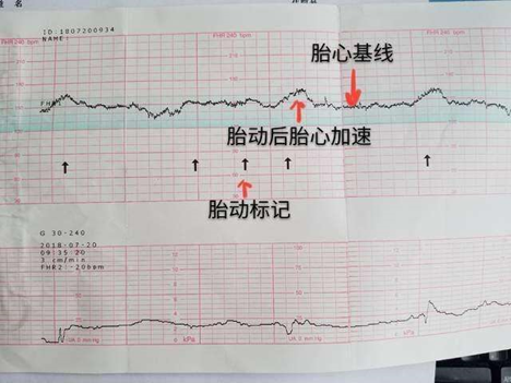 胎儿有哪5怕，孕妇坚持不触碰有助于孩子健康发育