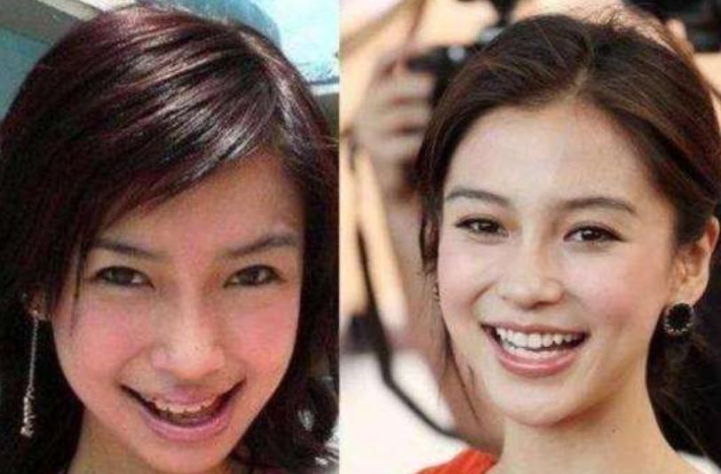 baby整容前后照片(为什么anglebaby一直被离婚)