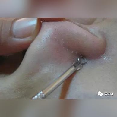 武汉协和鼻子价格的长尾关键词有哪些