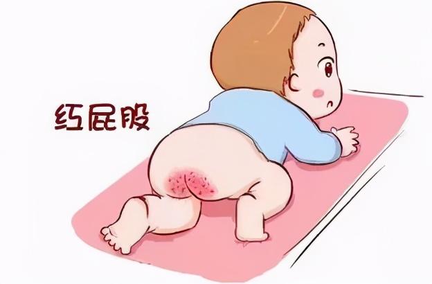 该不该给宝宝穿开裆裤