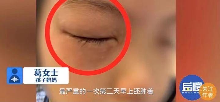 梦见自己手肿了