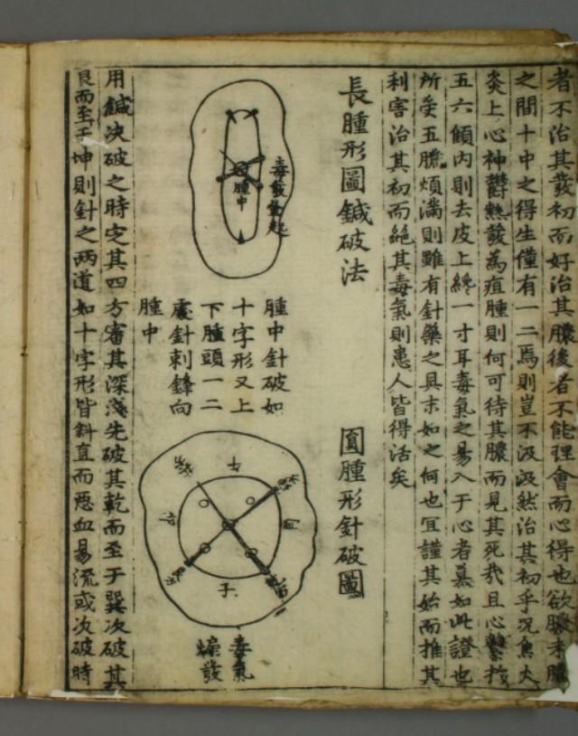 中医药论文参考文献自动生成什么病中医束手无策而西医手到病除的