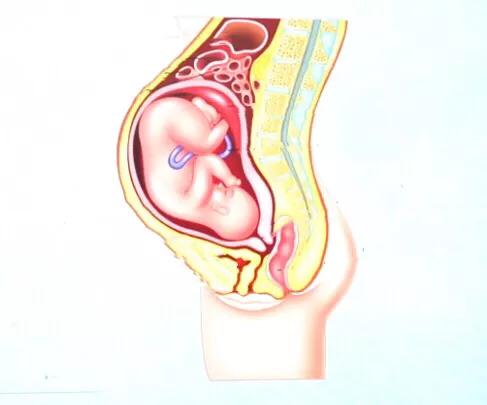 束身衣有可能造成臀围变大吗 束身衣有可能造成臀围变大吗