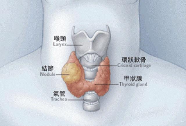 体检出现增生结节等异常要紧吗