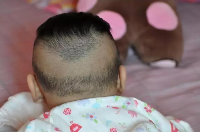 孩子睡觉后脑勺出汗很多